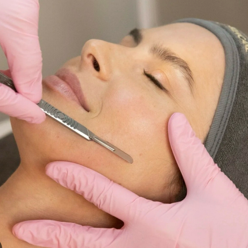 Dermaplaning Facial at Enchanted Esthetics in West Union, OH