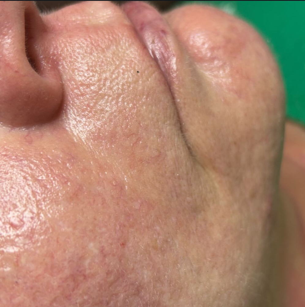 Lip + Chin Wax