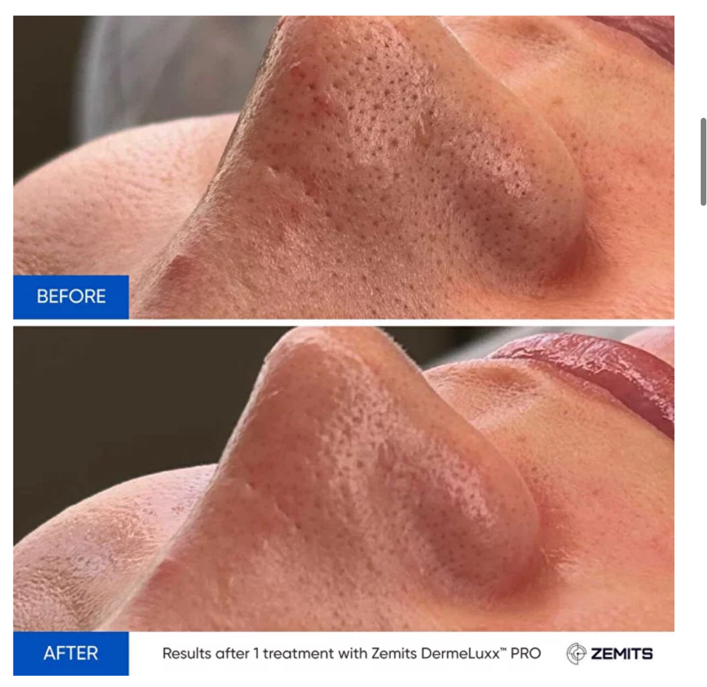 Hydrodeluxx Facial