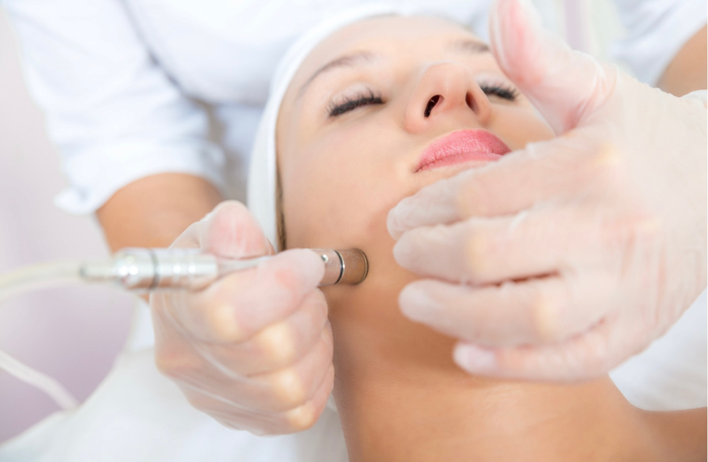 Microdermabrasion