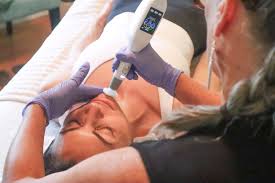 Jet Plasma Treatment For Face