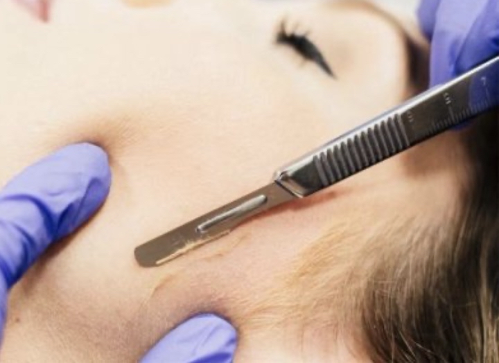 Dermaplane + Microdermabrasion