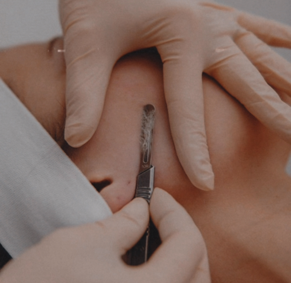 Dermaplaining (Add On To A Facial )