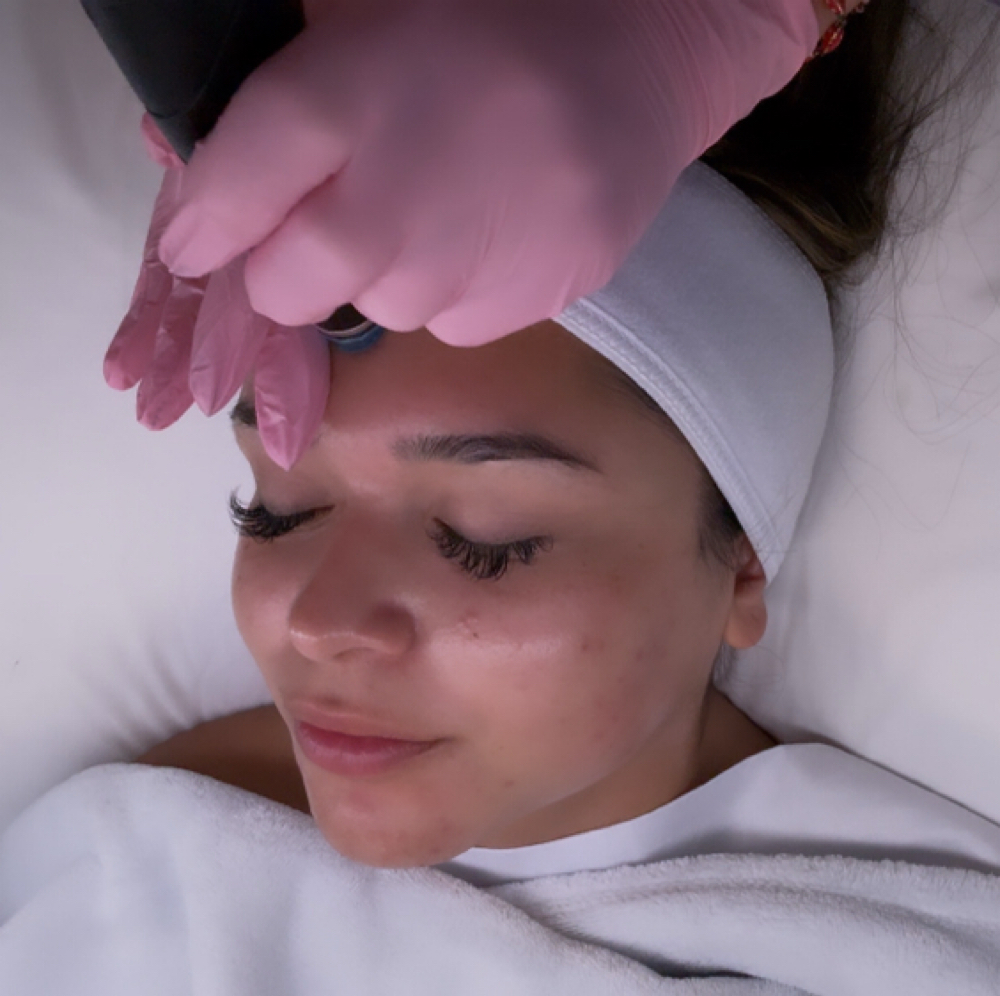 FLAWLESS GLOW at Mattie’s Aesthetics in Aptos, CA