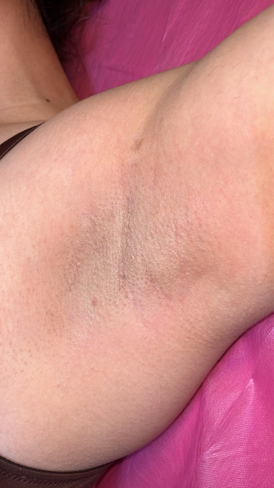 Underarm Wax