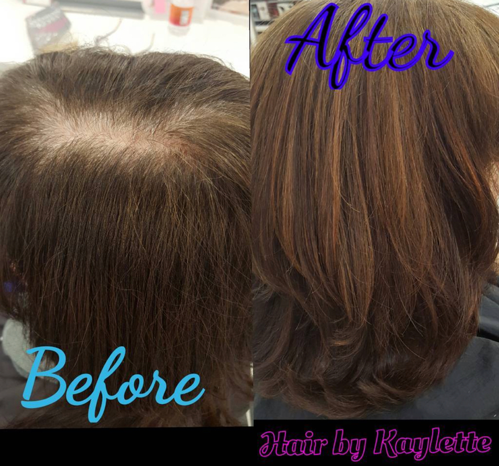 Root Retouch