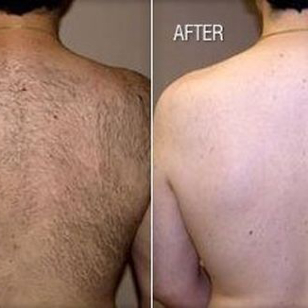 Sacred Luxe Back Wax at Sacred Luxe Beauty in Lithicum Heights, MD