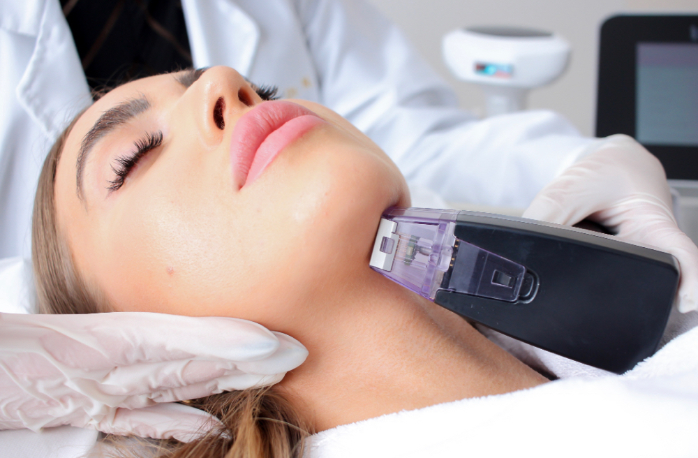 Morpheus 8/ Skin Tightening