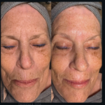 The Best Facial Ever ®💧