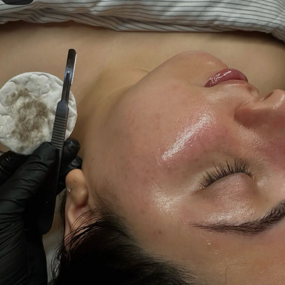 Dermaplane Service at The Faceologist in Columbus, OH