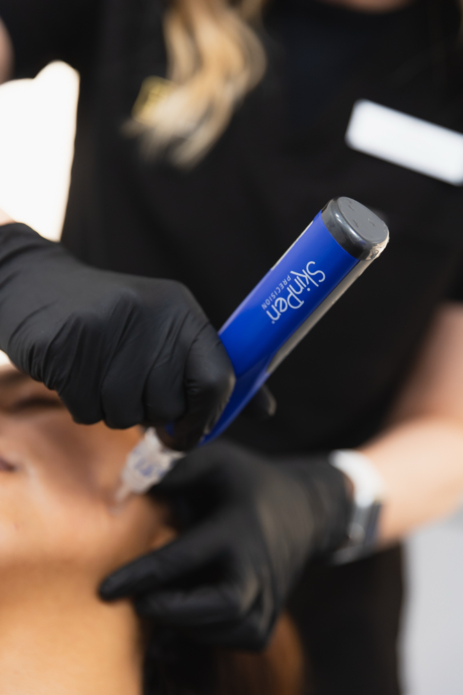 Microneedling - Neck & Chest