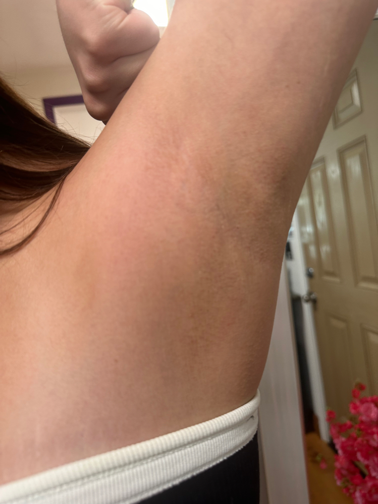 Underarm