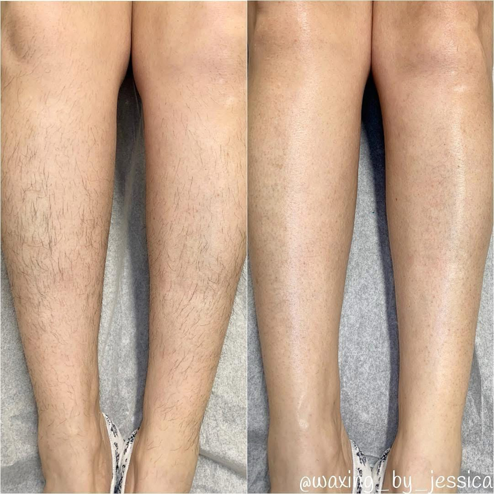 Lower Legs Wax