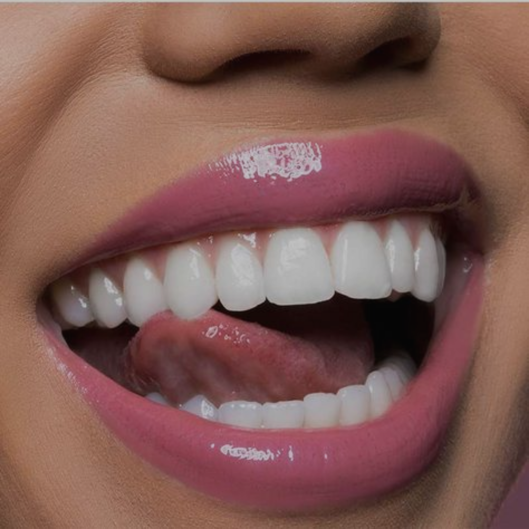 Ultra Whitening at The Dental Whitening Studio in Paradise Valley, AZ