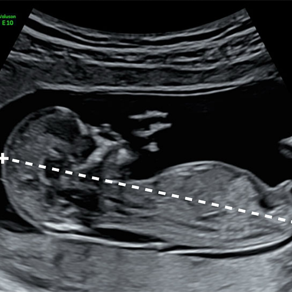 Just For Fun Measurements