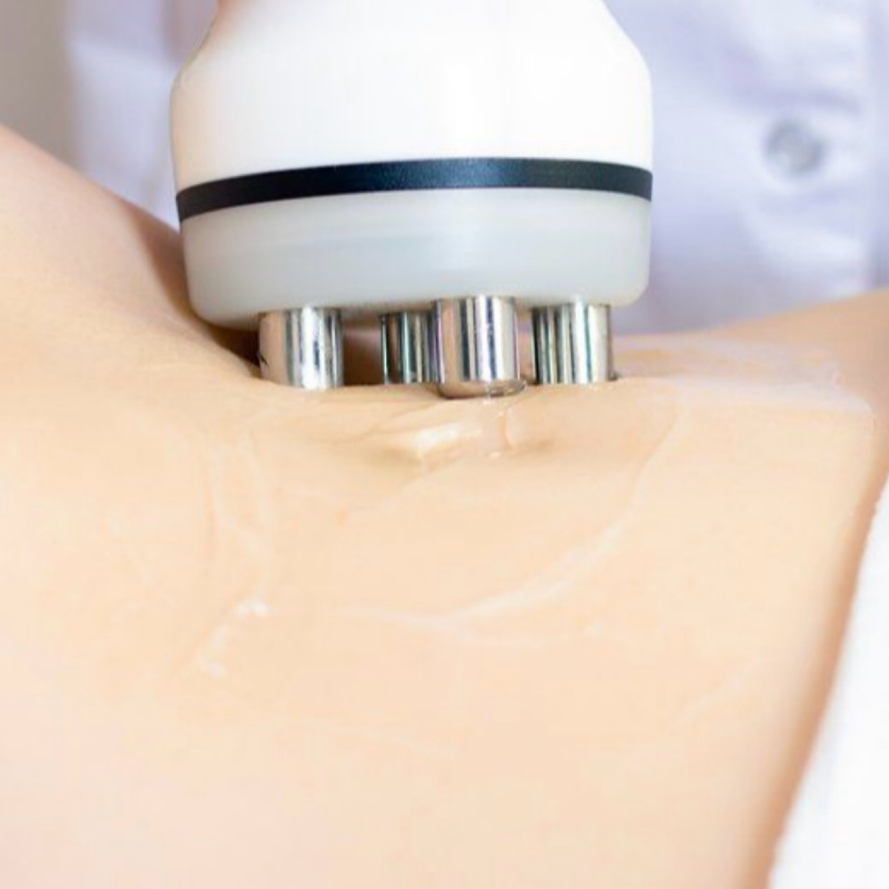 Ultrasonic Cavitation