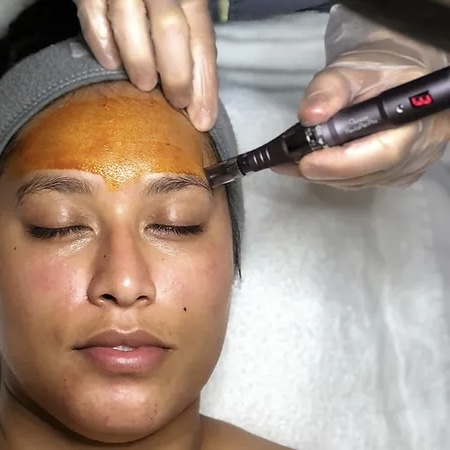 Vitalglow facial