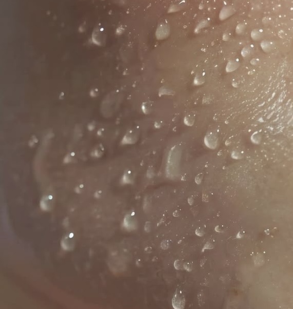 Hydrational Dermaplane