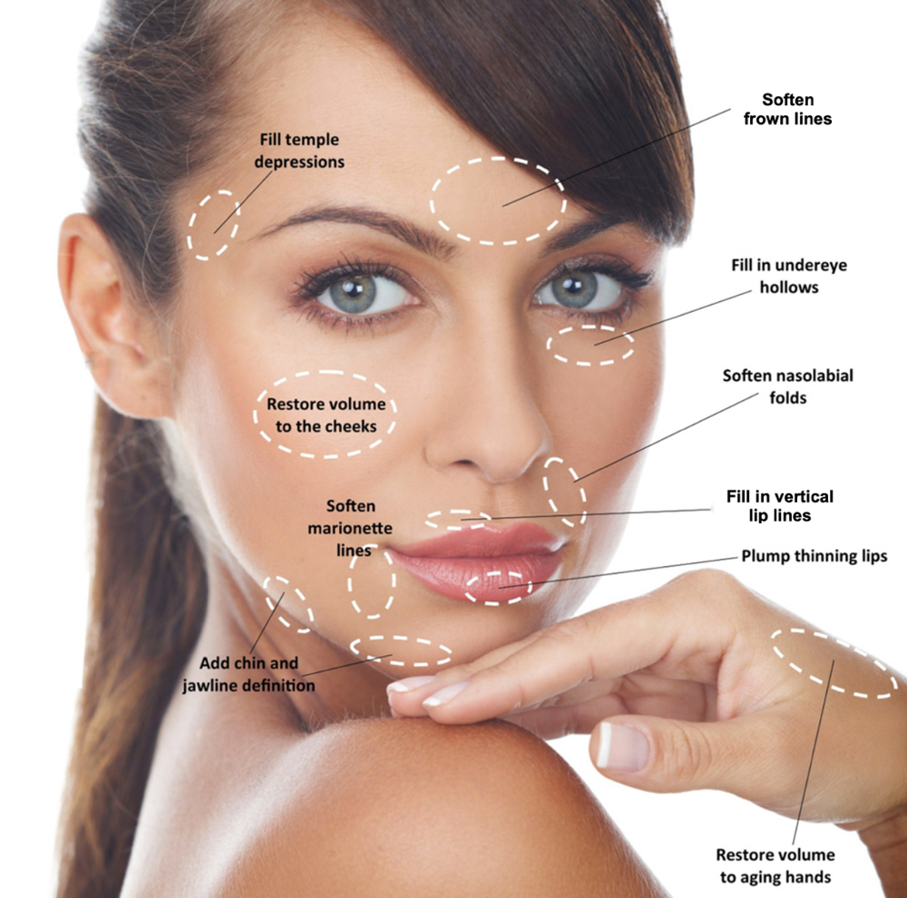 Dermal Filler-Face