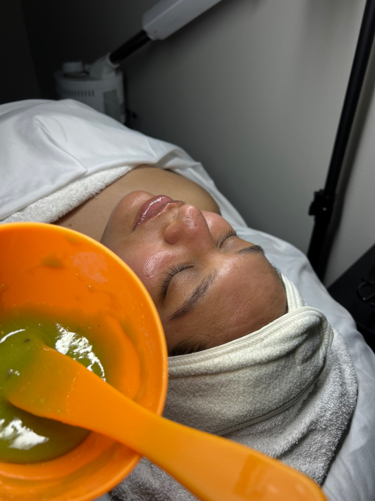 Facial- Chemical Peel