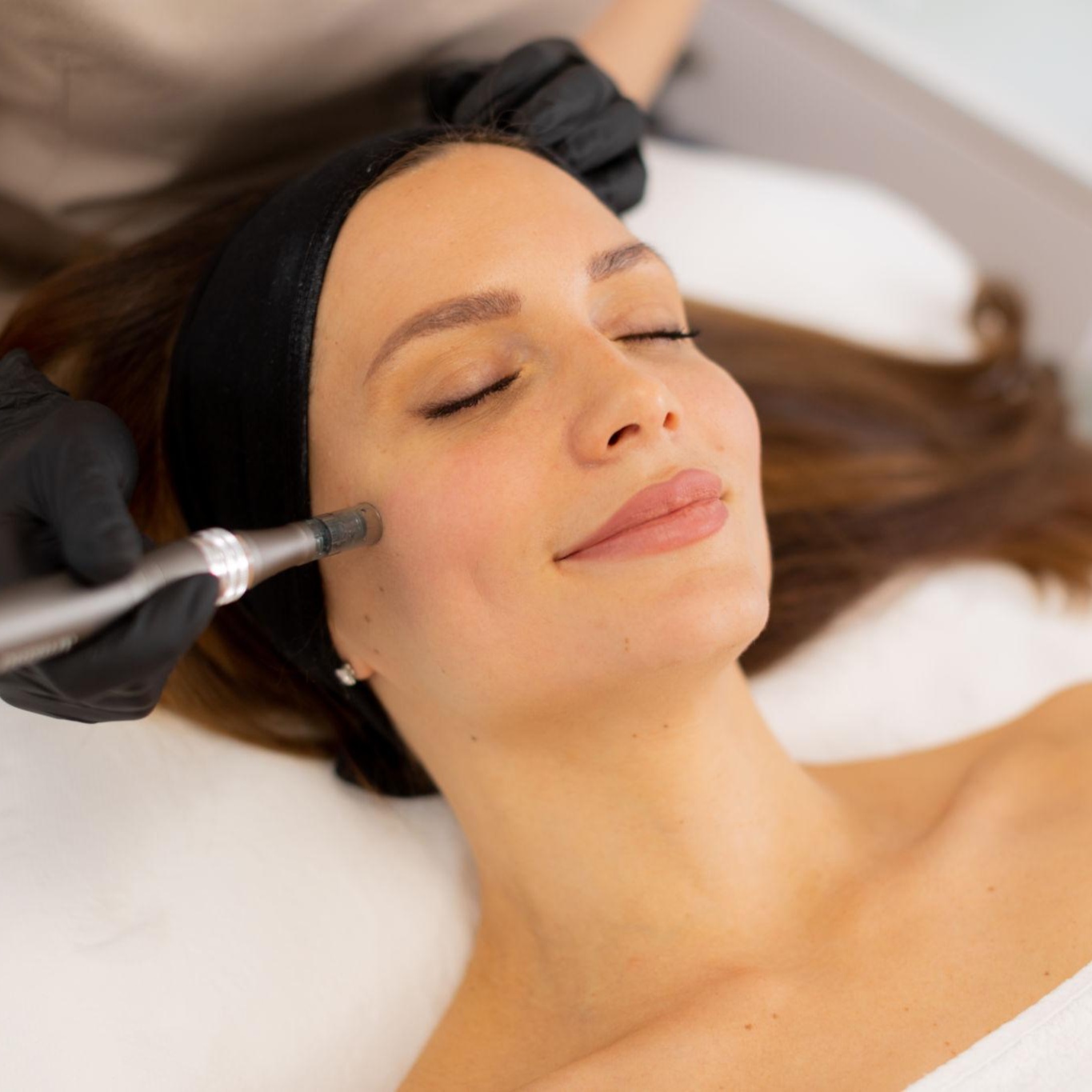 Consultation Microneedling at Angelic Medi Spa in Lynbrook, NY