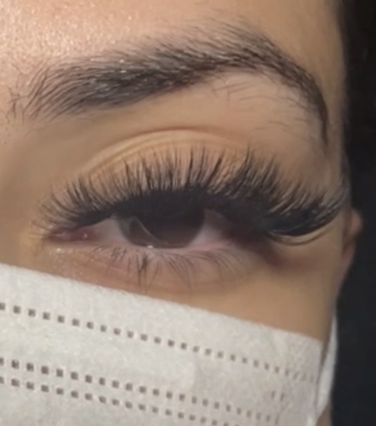 Hybrid Refill