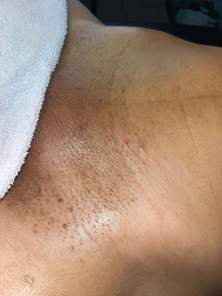 Brazilian Wax