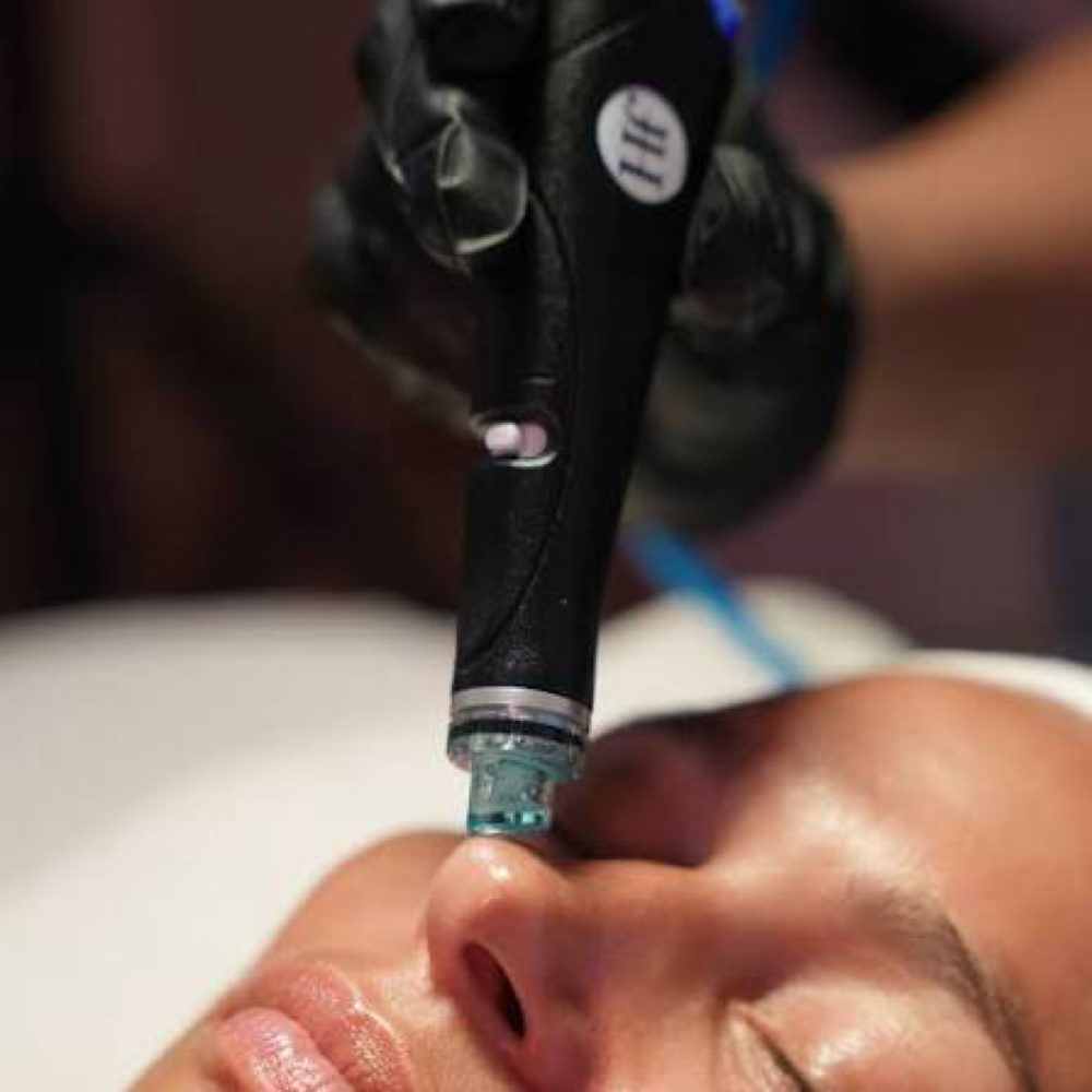 Deluxe Hydrafacial at Estetica Venice