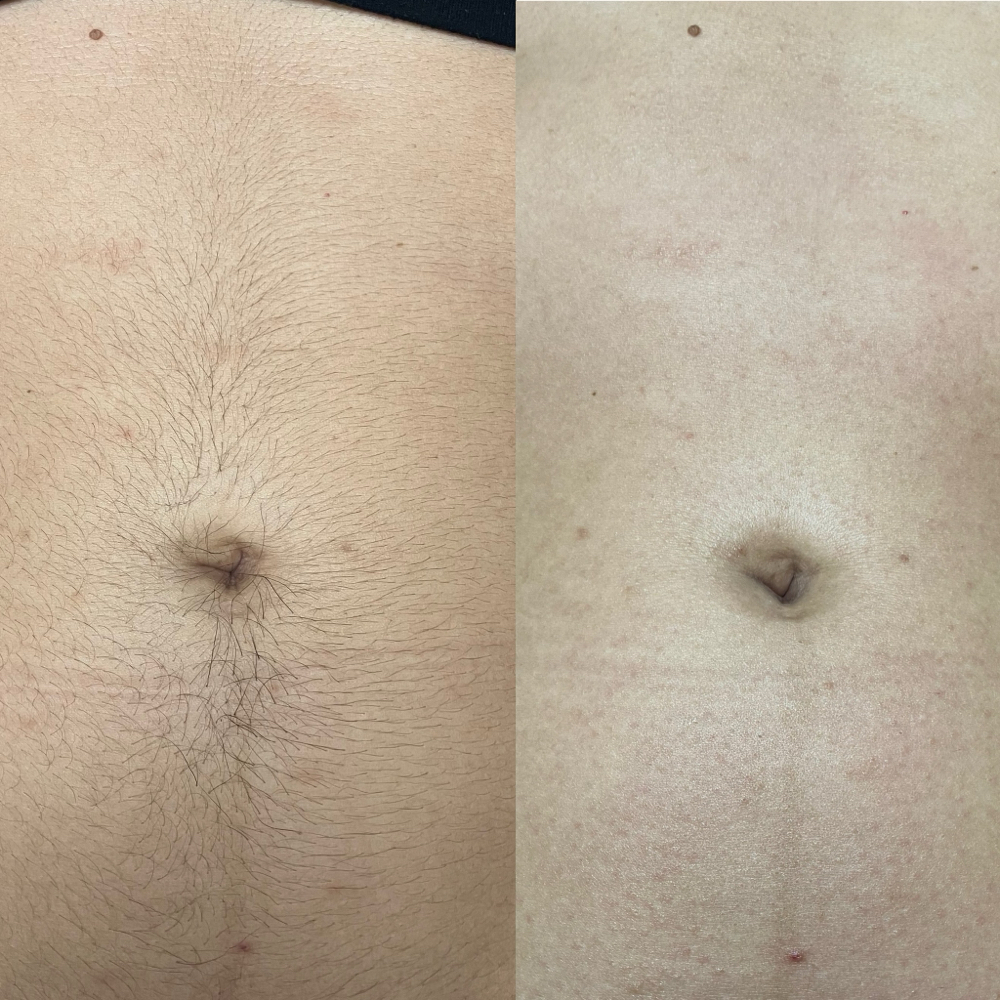Womens Full Stomach