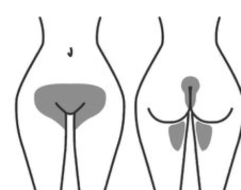 Brazilian - Women Only at The Glam Architect in Lakewood, CO