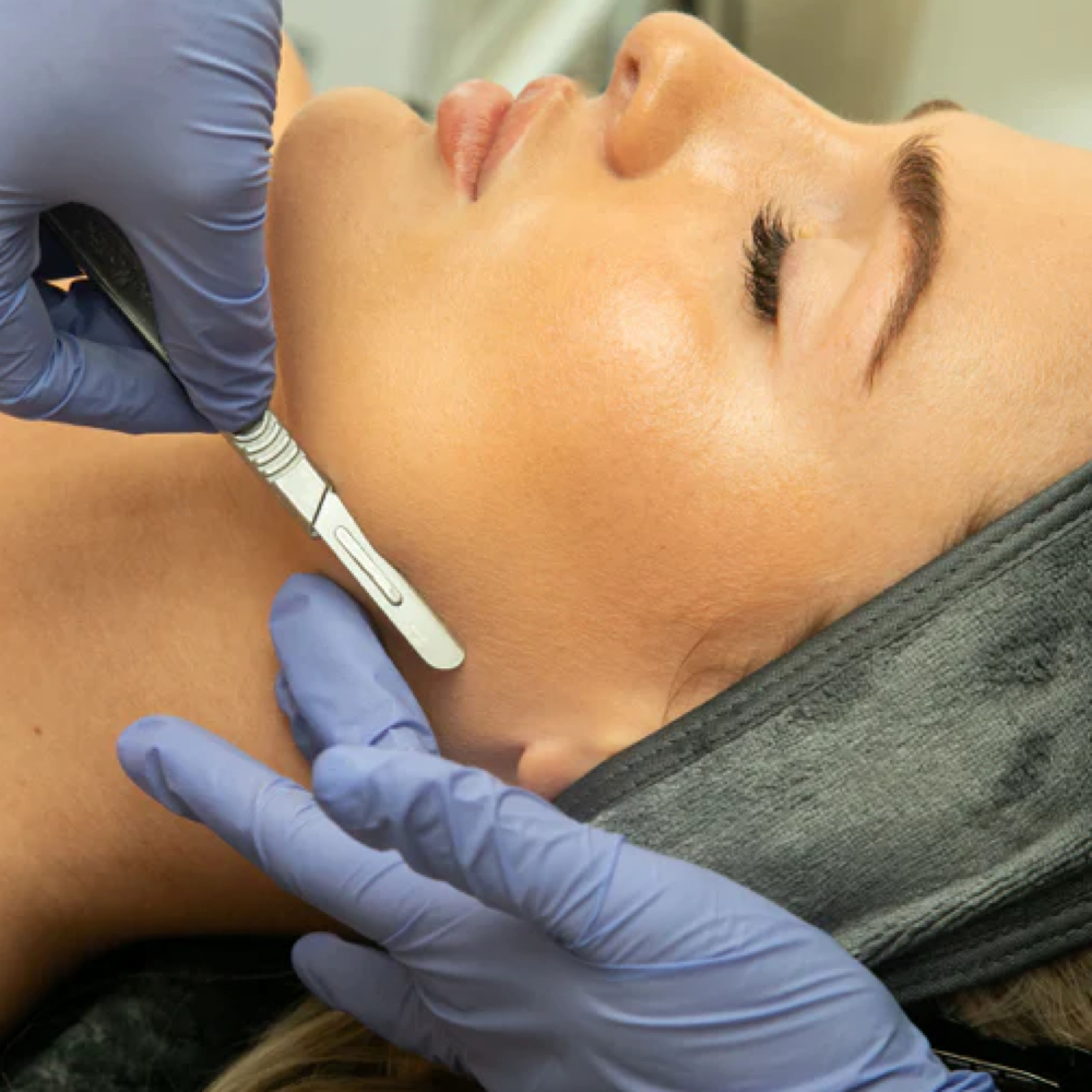 Glass Skin Dermaplane at The Retreat / by Maggie Reese in Ca, CA