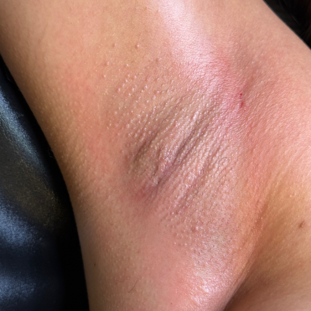 Armpit Wax at Desire Esthetics in Lodi, CA