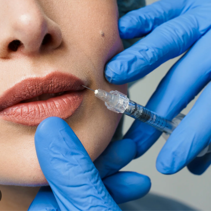 Dissolve Filler at Knight Aesthetics in Lawton, OK