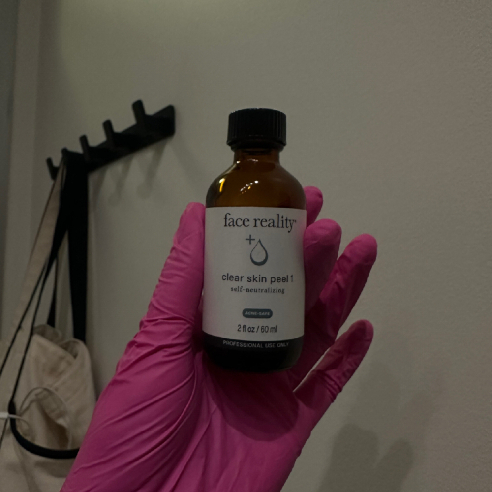 Acne Bootcamp at Jenerationbeautyla in Torrance, CA