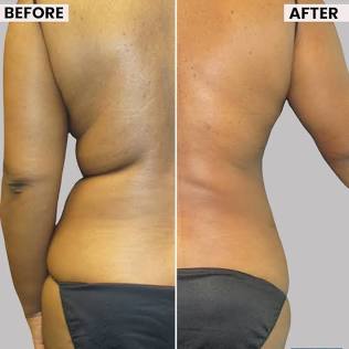 Body 360