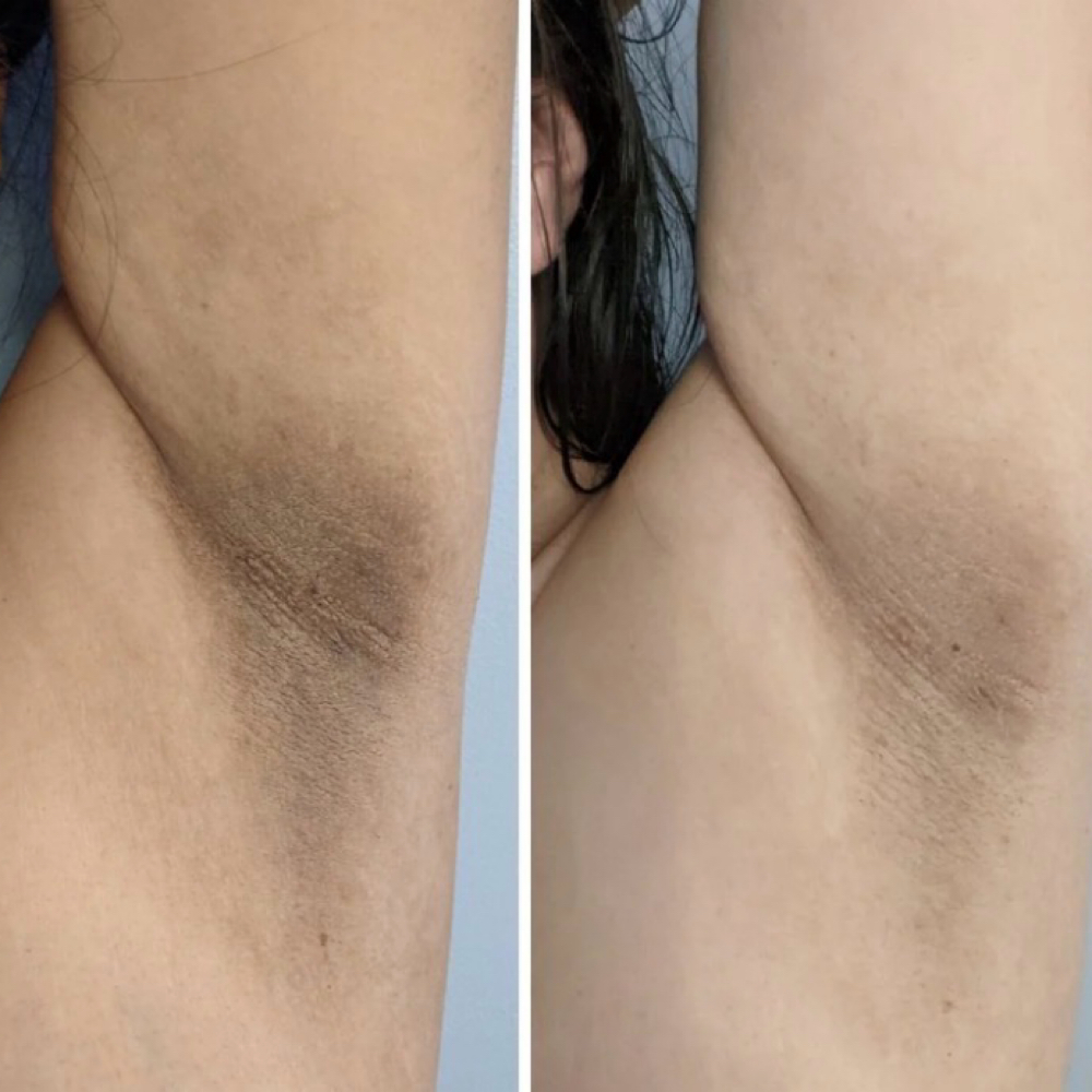 Intimate Illumination Underarms at Anastasia’s Crown in Pittsburgh (Shadyside Area), PA