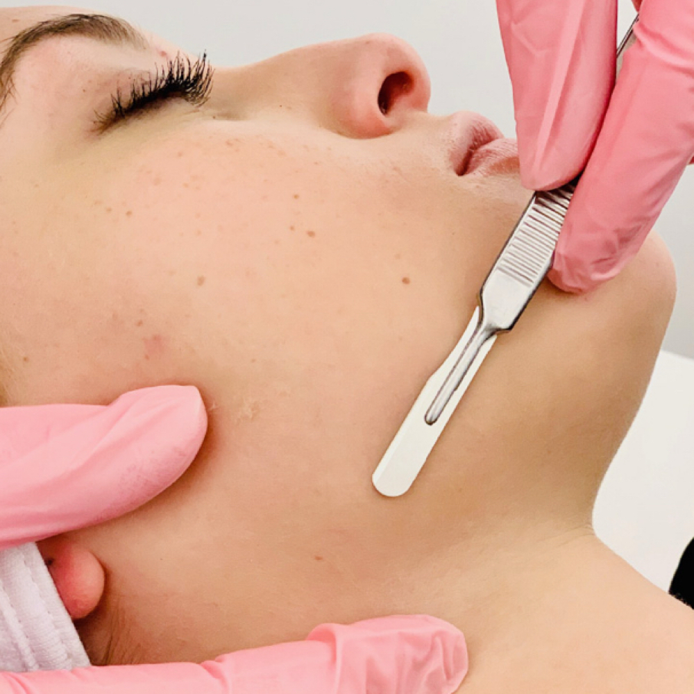 DERMAPLANE ADD-ON at Sabreena Frances Artistry LLC in Starkville, MS