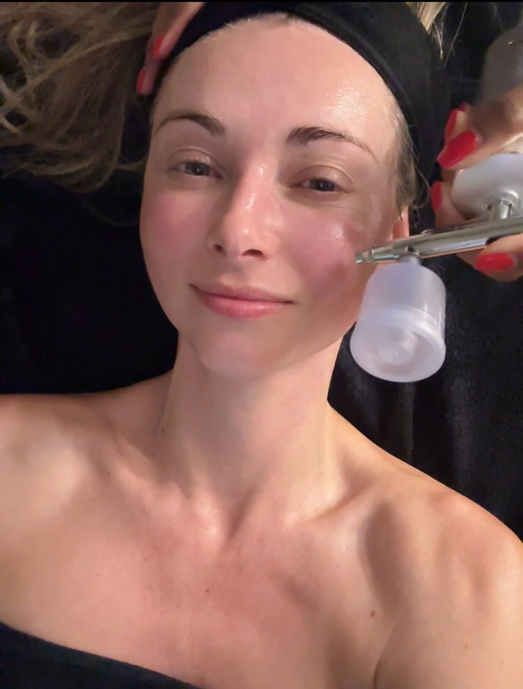 Oxygen Infusion Add On at Skin88 Studio in Beverly Hills, CA