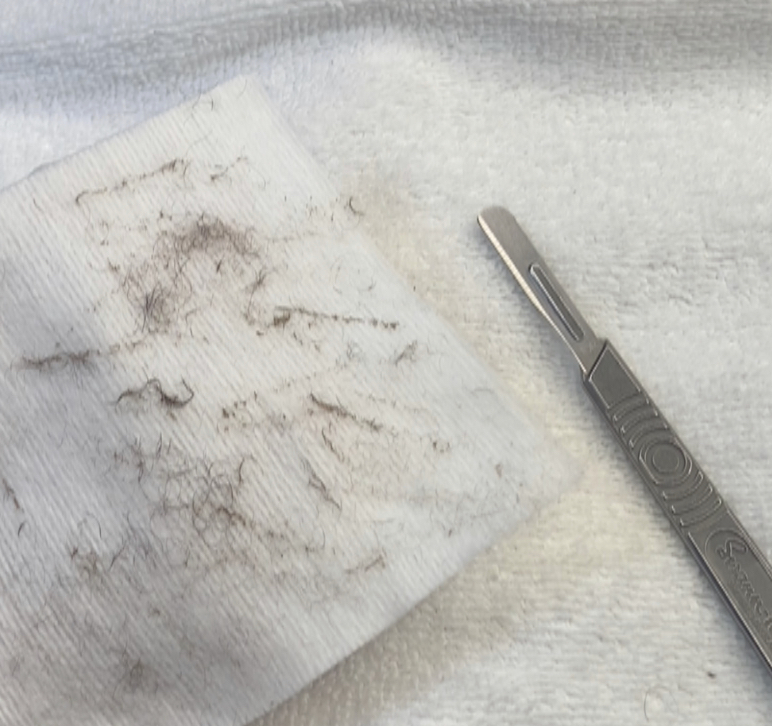 Dermaplaning Facial Extended