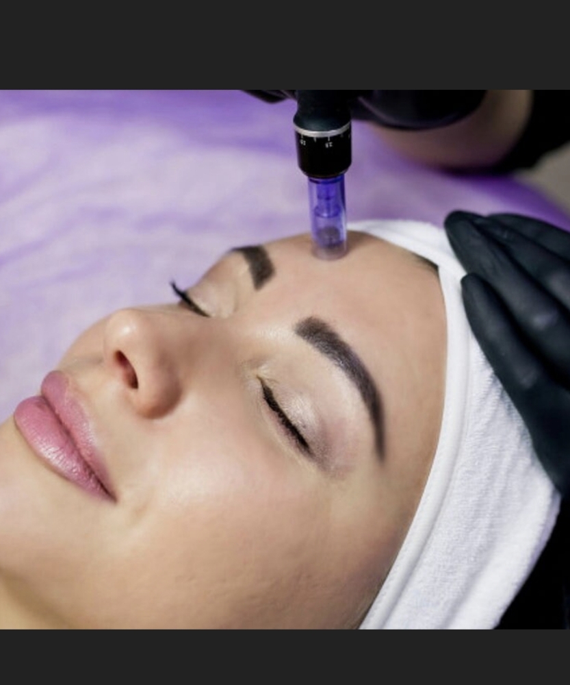 STAMPING MICRONEEDLING
