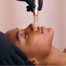 Nano Needling Add On