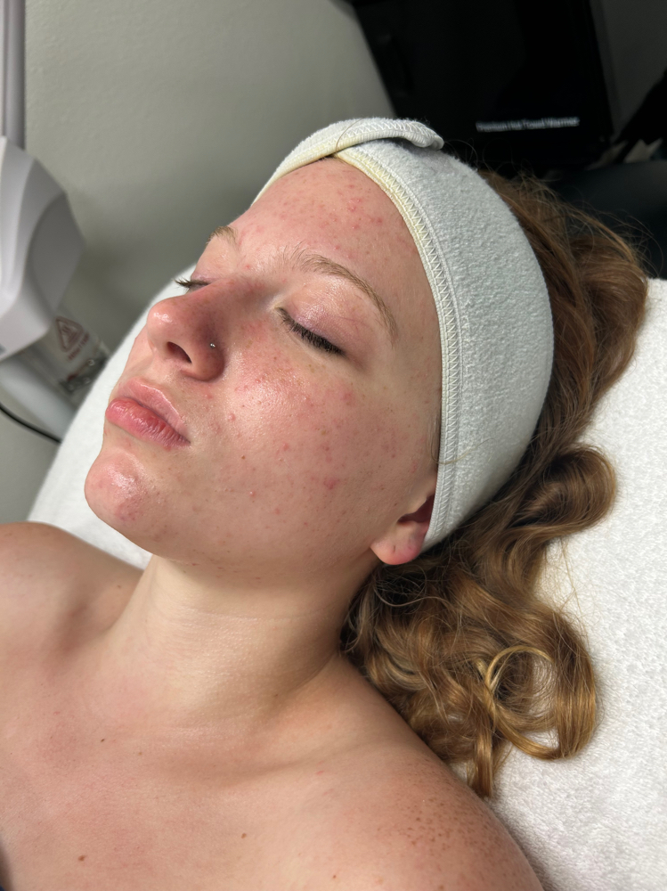 Teen Purity Facial at Sona’s Esthetics in Rocklin, CA