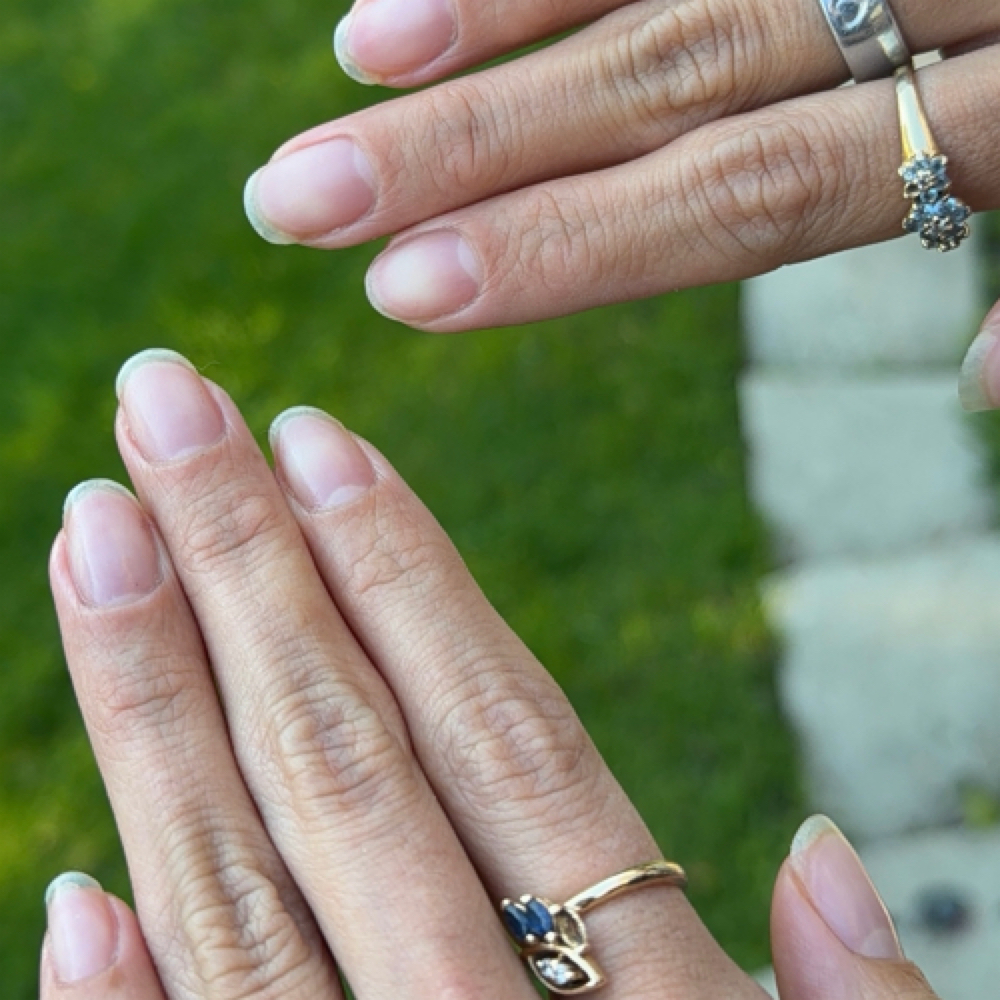 REMOVAL at HLS NAIL LAB in Rockland, NY