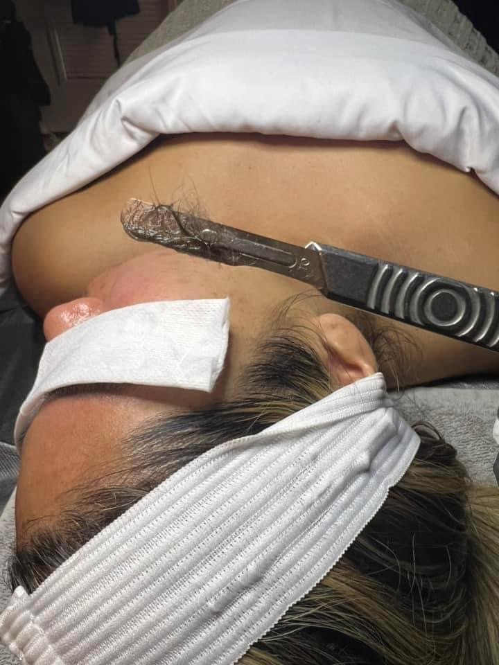 Dermaplaning Add-On