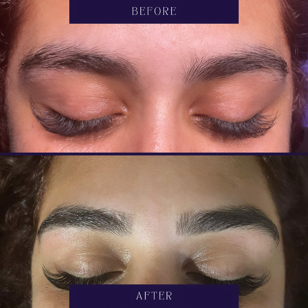 BROW THERAPY
