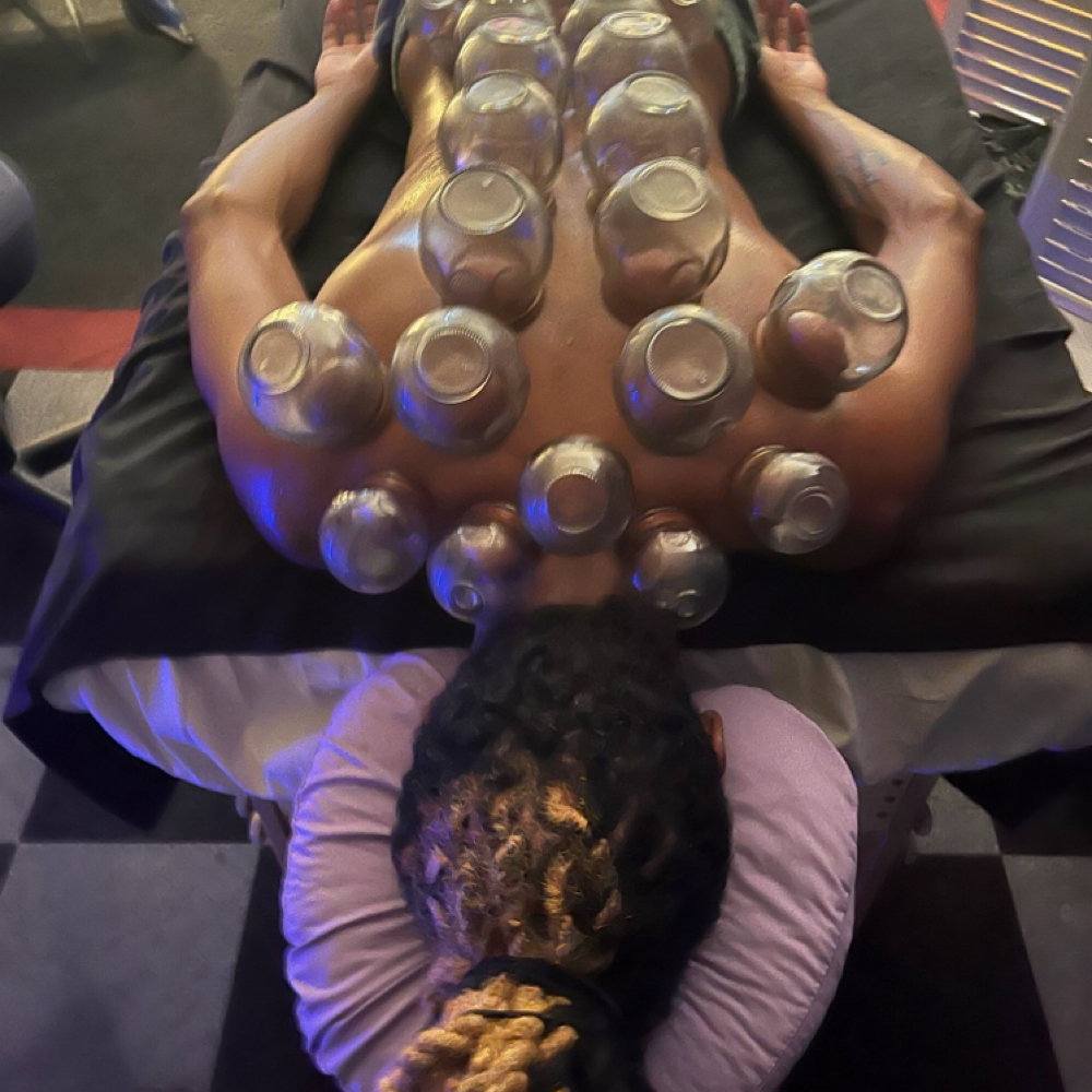 Fire Cupping at Abundant Healing