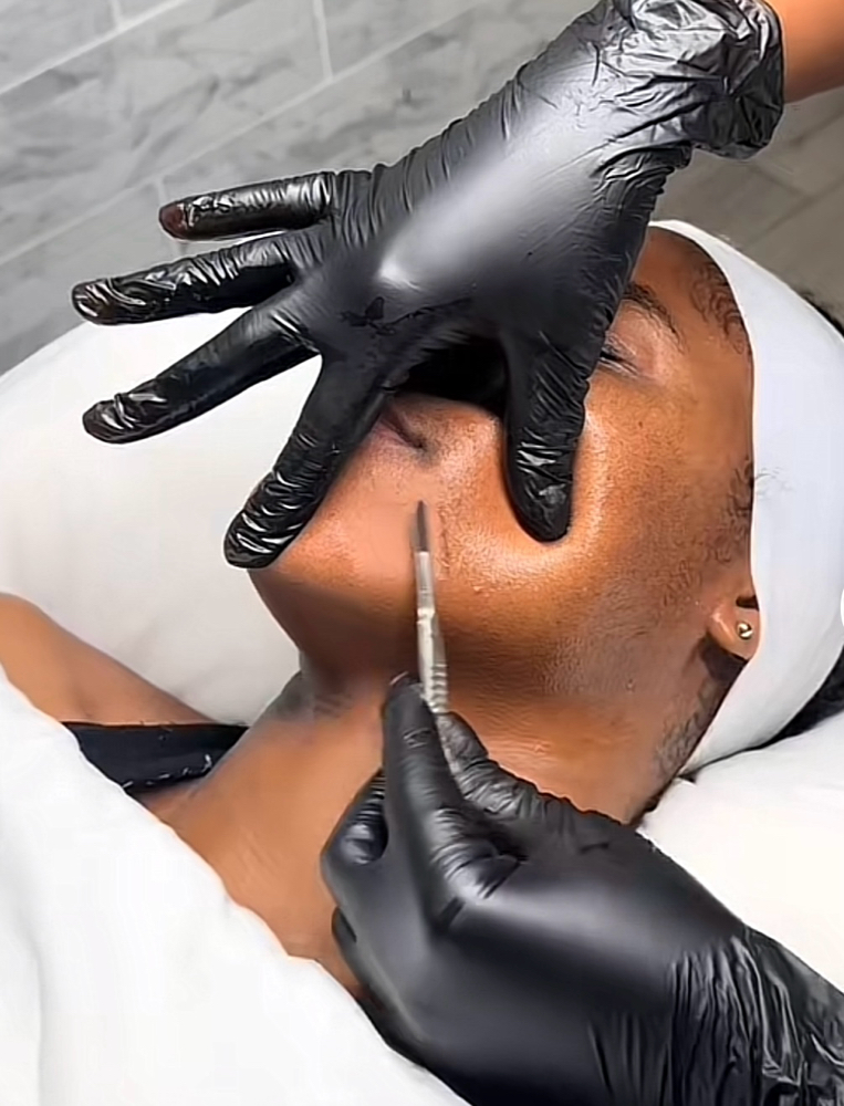 Dermaplane
