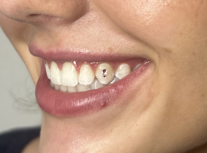 Tooth Gem at GlossedByGracee in Rexburg, ID