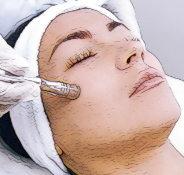 Microddermabrasion Add-on