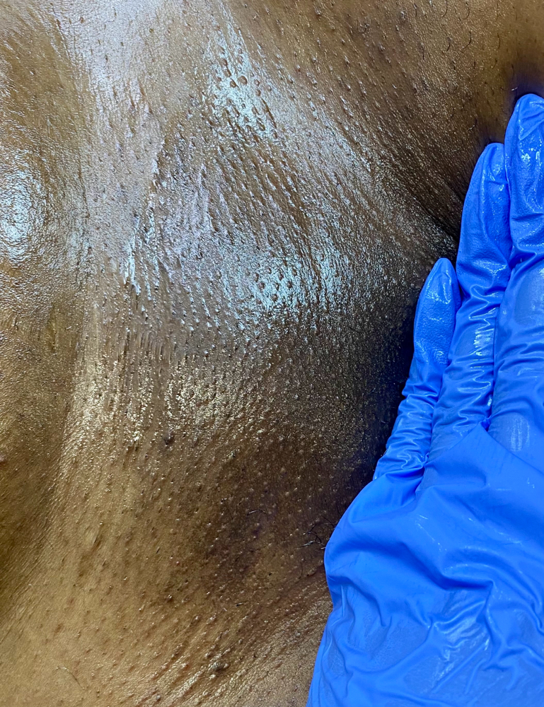 Waxing - Brazilian